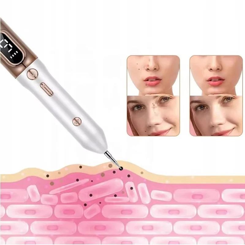Plasma Pen To Remove Skin Tags, Moles And Warns