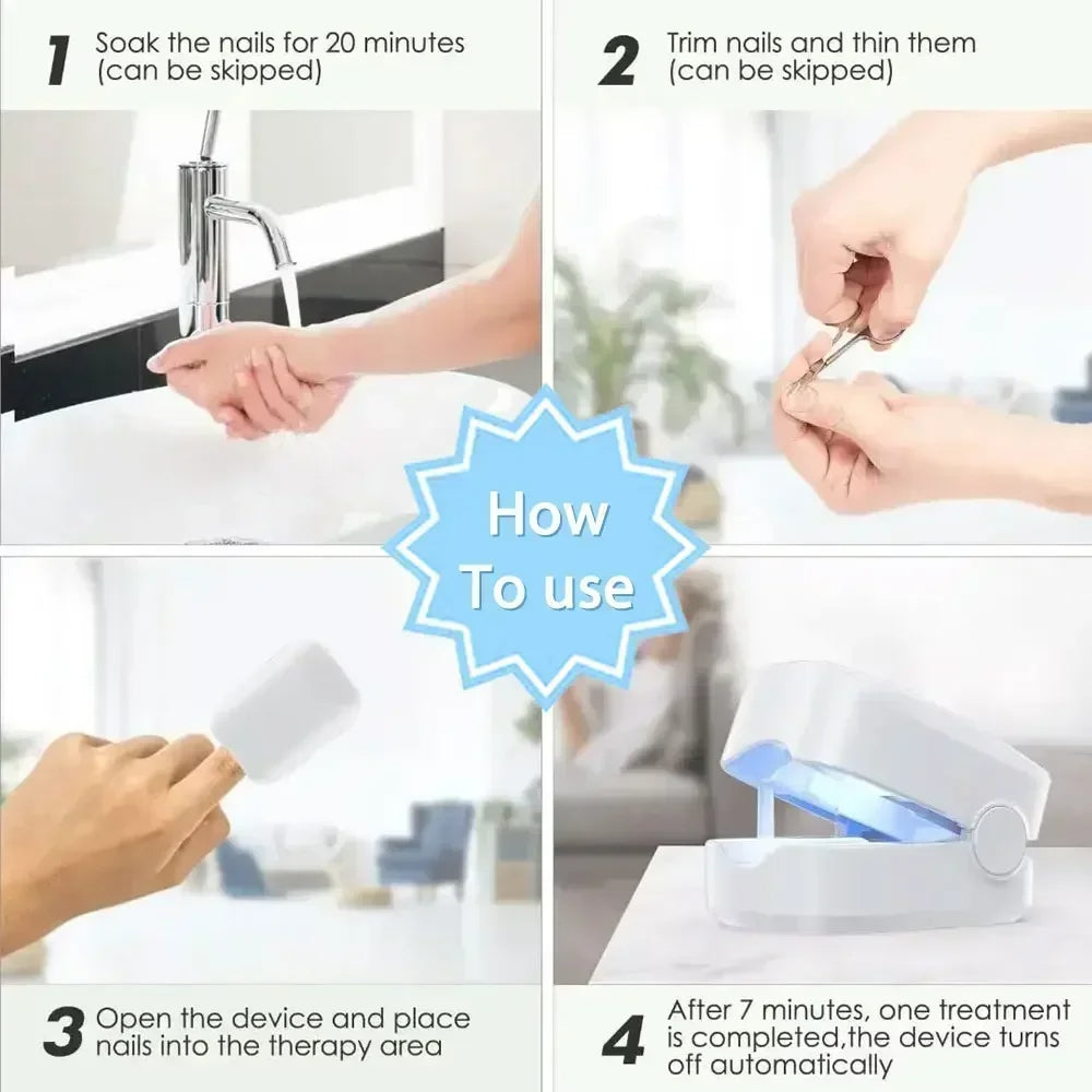 Nail Fungus Cleaning Laser Device - Expert Revolutionary High-Efficiency Light Therapy Device For Toenail Diseases