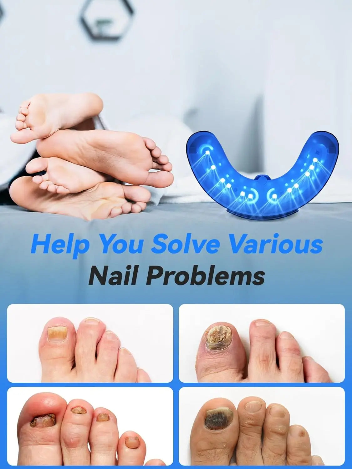 Nail Laser Fungus Device