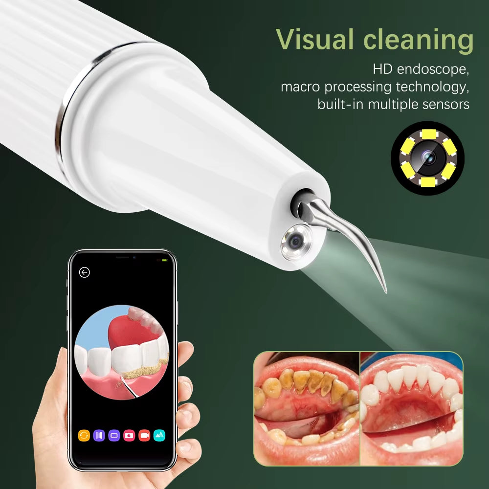 Professional Ultrasonic Dental Cleaner | Advanced Plaque & Tartar Remover