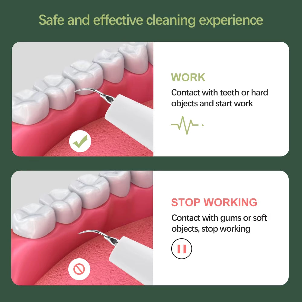 Professional Ultrasonic Dental Cleaner | Advanced Plaque & Tartar Remover