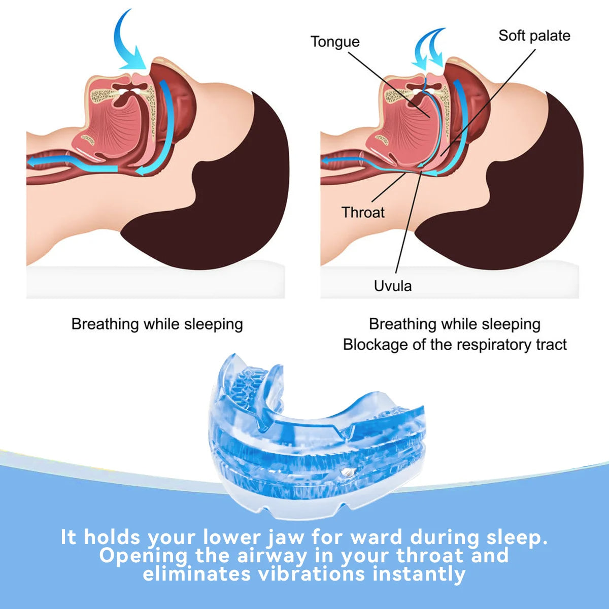 Adjustable anti-snoring mouthpiece
