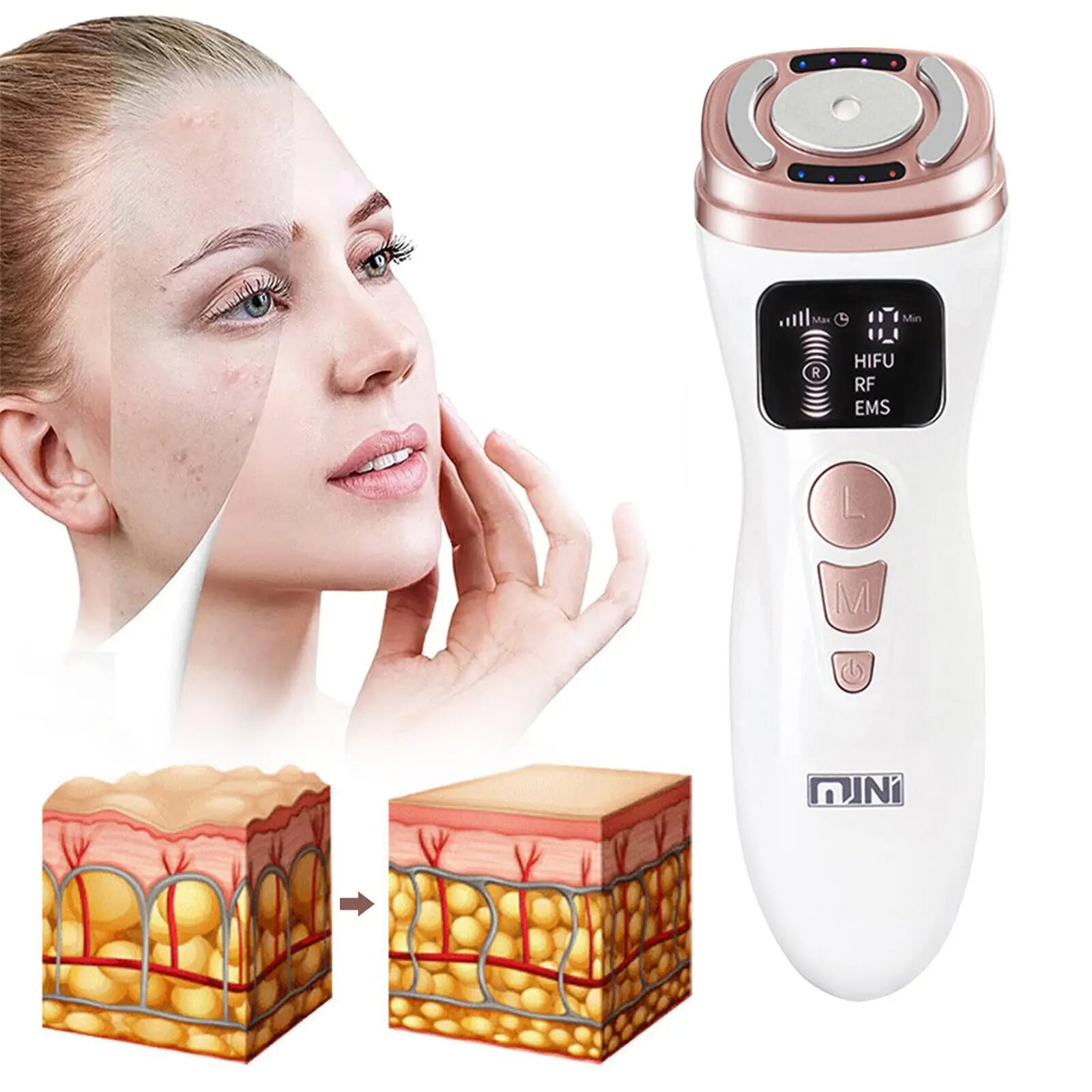 Home RF Skin Tightening - Portable Mini Ultrasound RF Device