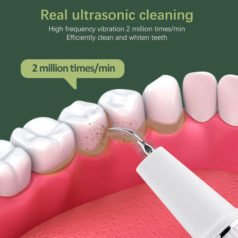 Professional Ultrasonic Dental Cleaner | Advanced Plaque & Tartar Remover